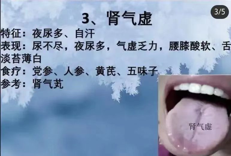 舌诊