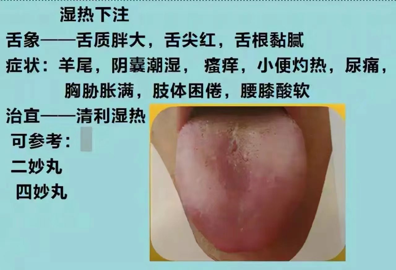舌诊