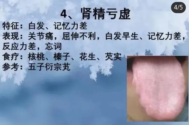 舌诊