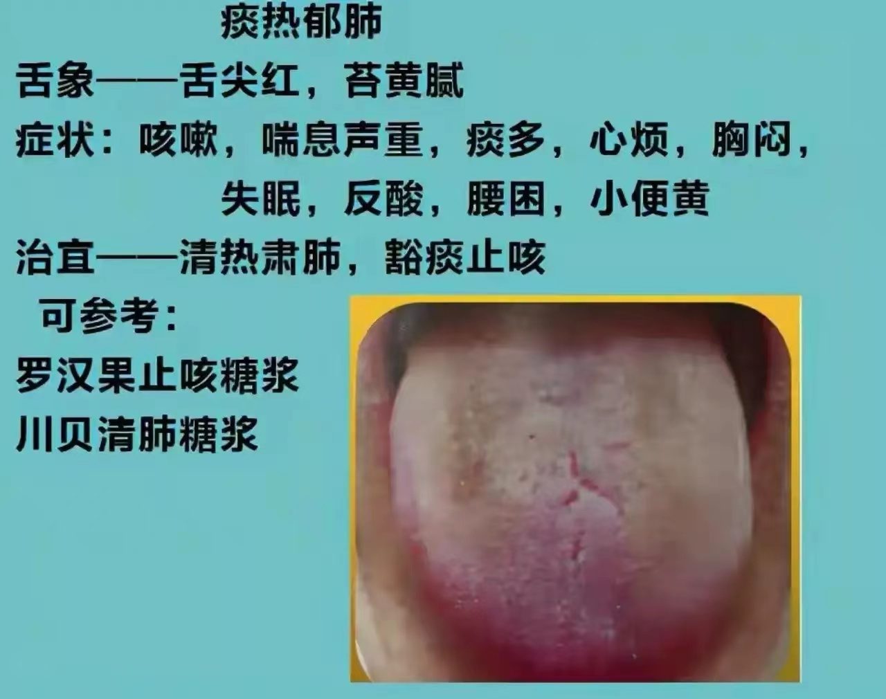 舌诊