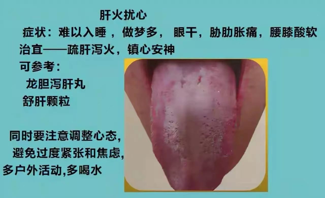 舌诊