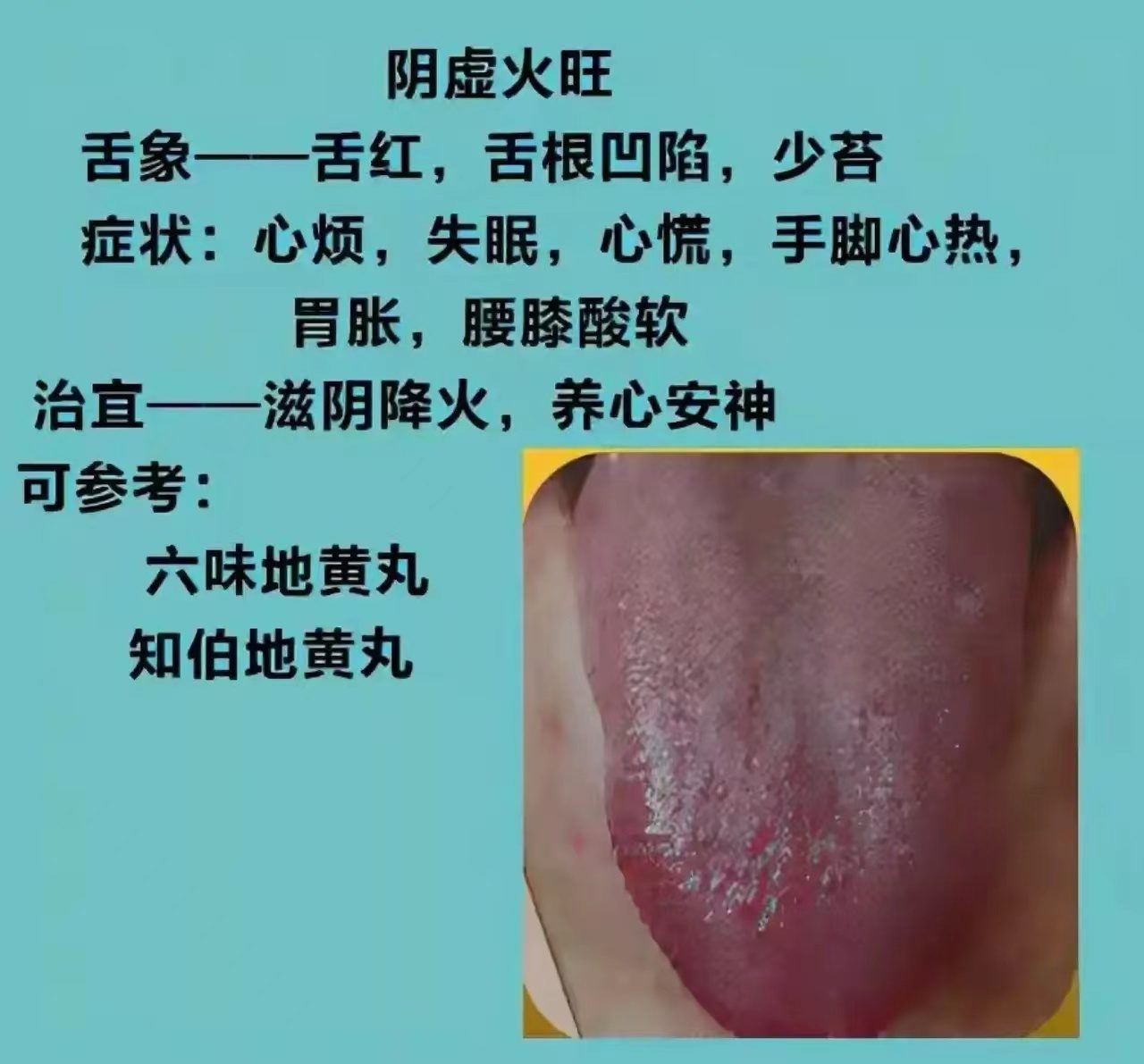 舌诊