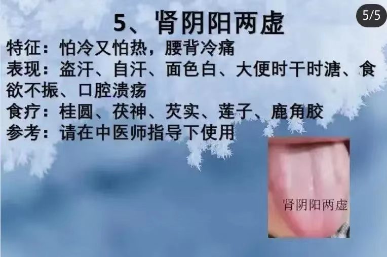 舌诊