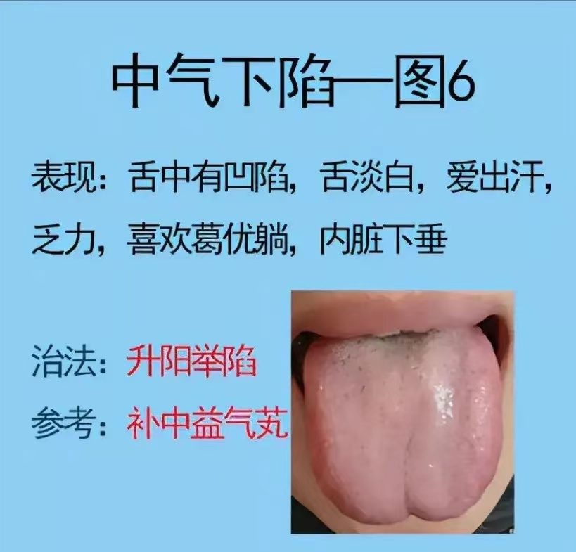 舌诊