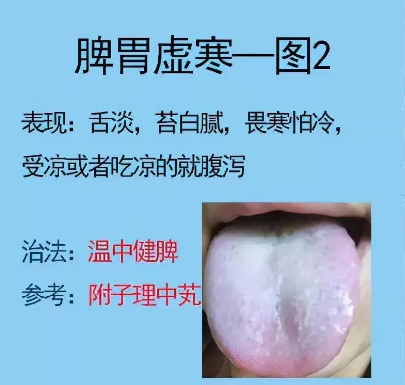 舌诊