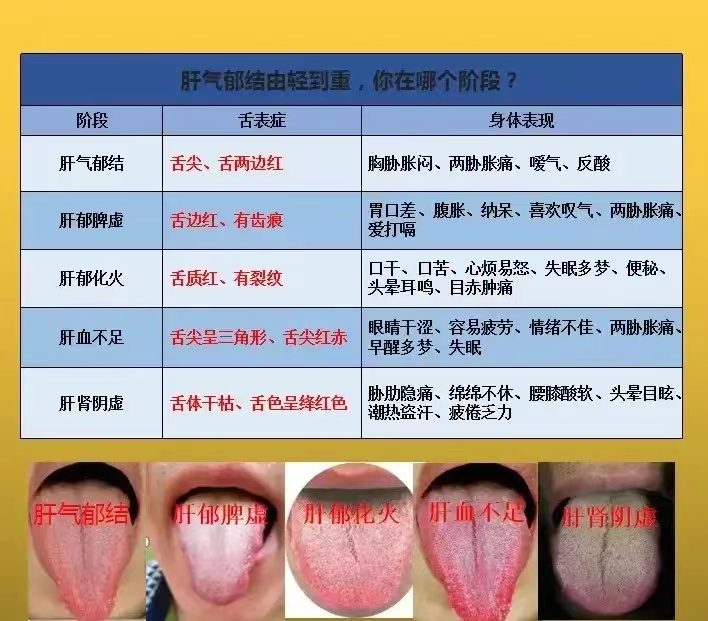 舌诊